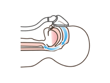 ��̲��̵�Ƶ۾ɸ�����CPAP���Ť��Ĥ餤�������˺��㲿�������夹��Ф褤?